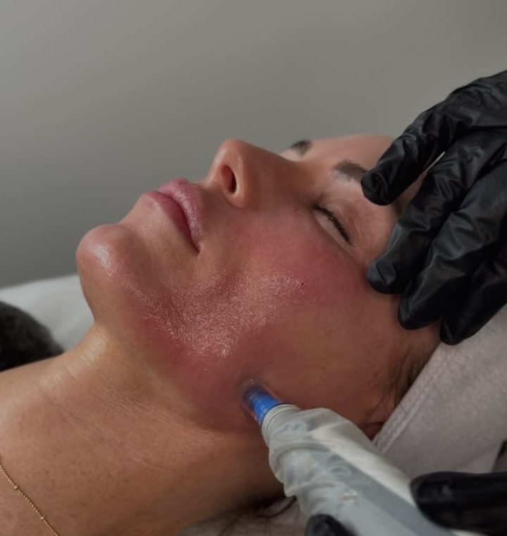 Meraki Skin treatment photo of facial treatment